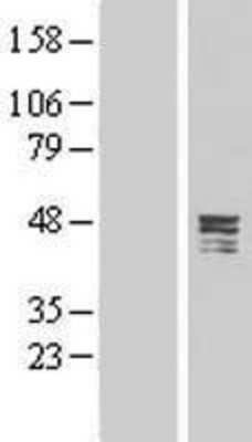 Western Blot: CPA5 Overexpression Lysate [NBL1-09427]