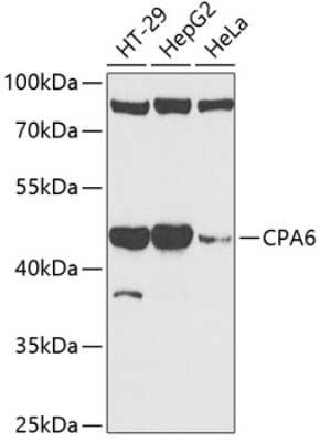 Western Blot: CPA6 AntibodyBSA Free [NBP2-92859]