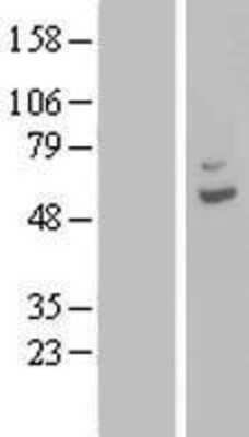 Western Blot: CPA6 Overexpression Lysate [NBL1-09428]