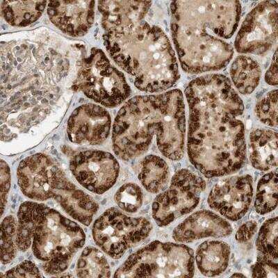 Immunohistochemistry: CPAMD8 Antibody [NBP1-93661]