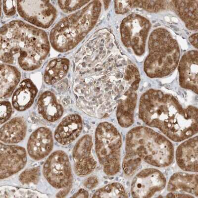 Immunohistochemistry: CPAMD8 Antibody [NBP2-38178]