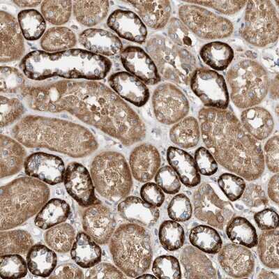 Immunohistochemistry: CPAMD8 Antibody [NBP2-38179]