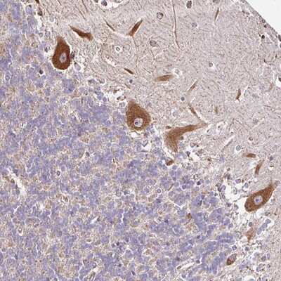 Immunohistochemistry-Paraffin: CPD Antibody [NBP2-13866]