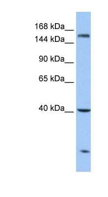 Western Blot: CPD Antibody [NBP1-91447]