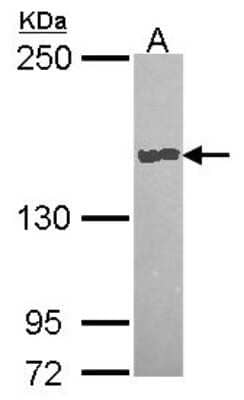 Western Blot: CPD Antibody [NBP2-15979]