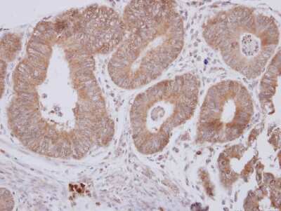 Immunohistochemistry-Paraffin: CPEB1 Antibody [NBP2-15981]
