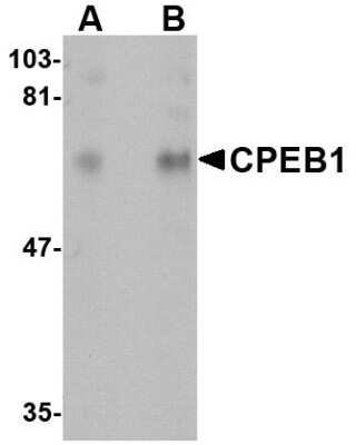 Western Blot: CPEB1 AntibodyBSA Free [NBP1-76365]