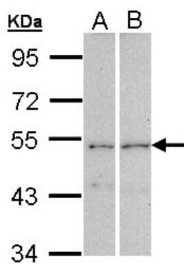 Western Blot: CPEB1 Antibody [NBP2-15980]