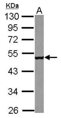 Western Blot: CPEB1 Antibody [NBP2-15981]