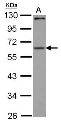 Western Blot: CPEB1 Antibody [NBP2-15982]