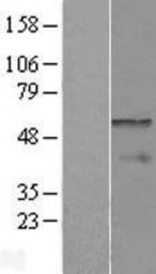 Western Blot: CPEB1 Overexpression Lysate [NBL1-09432]