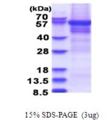 SDS-PAGE: Recombinant Human CPEB1 His Protein [NBP2-51672]