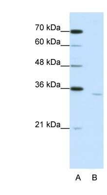 Western Blot: CPEB2 Antibody [NBP1-57259]