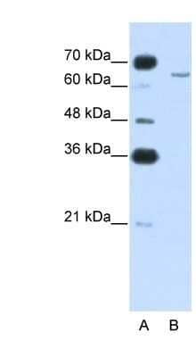 Western Blot: CPEB2 Antibody [NBP1-57416]