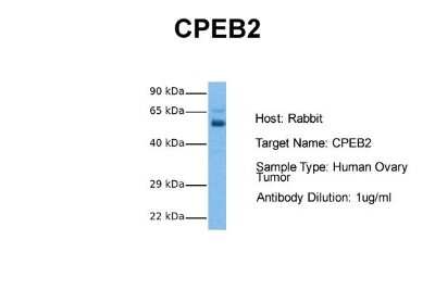 Western Blot: CPEB2 Antibody [NBP1-57459]