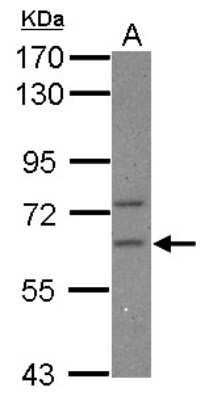 Western Blot: CPEB2 Antibody [NBP2-15983]