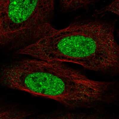 Immunocytochemistry/ Immunofluorescence: CPEB3 Antibody [NBP2-56833]