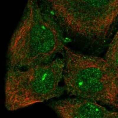 Immunocytochemistry/ Immunofluorescence: CPEB3 Antibody [NBP3-17235]