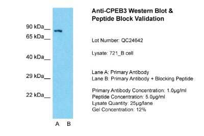 Western Blot: CPEB3 Antibody [NBP1-56919]