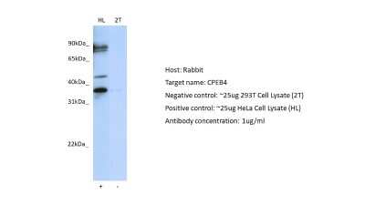 Western Blot: CPEB4 Antibody [NBP1-80468]