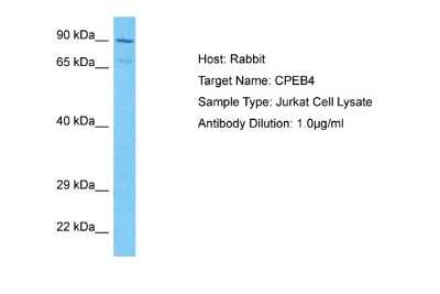 Western Blot: CPEB4 Antibody [NBP1-80468]