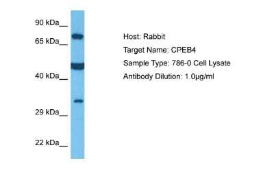 Western Blot: CPEB4 Antibody [NBP1-80468]