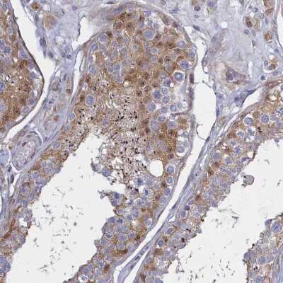 Immunohistochemistry: CPI17 alpha Antibody [NBP2-37897]