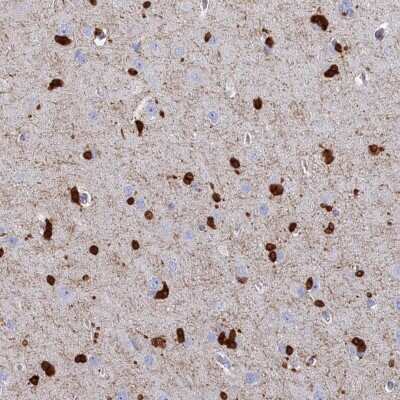 Immunohistochemistry-Paraffin: CPI17 alpha Antibody [NBP2-37897]