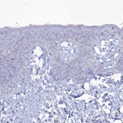 Immunohistochemistry-Paraffin: CPI17 alpha Antibody [NBP2-37897]