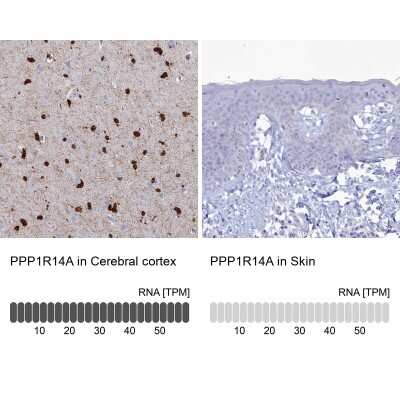 Immunohistochemistry-Paraffin: CPI17 alpha Antibody [NBP2-37897]