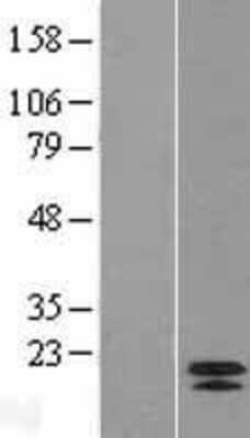 Western Blot: CPI17 alpha Overexpression Lysate [NBL1-14675]