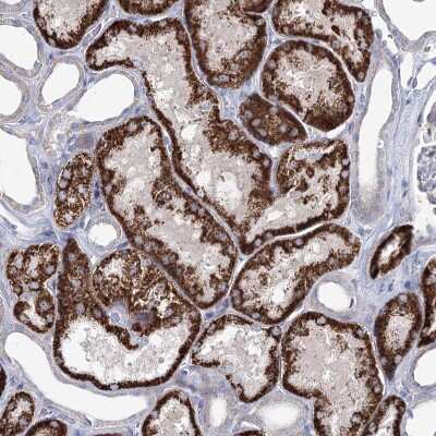 Immunohistochemistry-Paraffin: CPLANE1 Antibody [NBP1-94023]