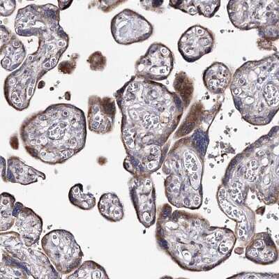 Immunohistochemistry-Paraffin: CPLANE1 Antibody [NBP1-94023]