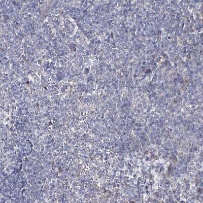 Immunohistochemistry-Paraffin: CPLANE1 Antibody [NBP1-94023]