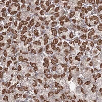 Immunohistochemistry-Paraffin: CPLANE1 Antibody [NBP2-32673]