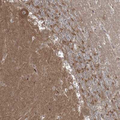 Immunohistochemistry-Paraffin: CPLANE1 Antibody [NBP2-32673]