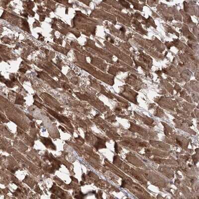 Immunohistochemistry-Paraffin: CPLANE1 Antibody [NBP2-32673]