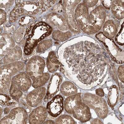 Immunohistochemistry-Paraffin: CPLANE1 Antibody [NBP2-32673]