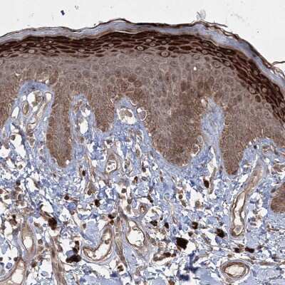 Immunohistochemistry-Paraffin: CPLANE1 Antibody [NBP2-32673]