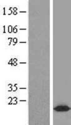 Western Blot: Complexin-2 Overexpression Lysate [NBL1-09436]