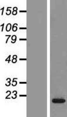 Western Blot: Complexin-2 Overexpression Lysate [NBP2-09835]