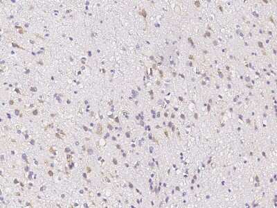 Immunohistochemistry-Paraffin: CPLX3 Antibody [NBP3-00305]