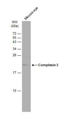 Western Blot: CPLX3 Antibody [NBP2-15985]