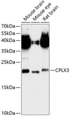 Western Blot: CPLX3 AntibodyAzide and BSA Free [NBP2-92119]