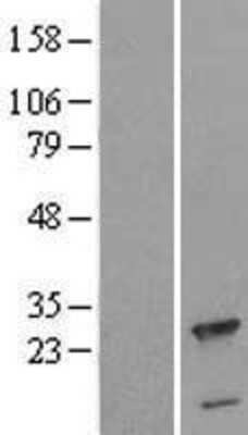 Western Blot: CPLX3 Overexpression Lysate [NBL1-09437]