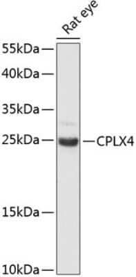 Western Blot: CPLX4 AntibodyAzide and BSA Free [NBP3-05573]