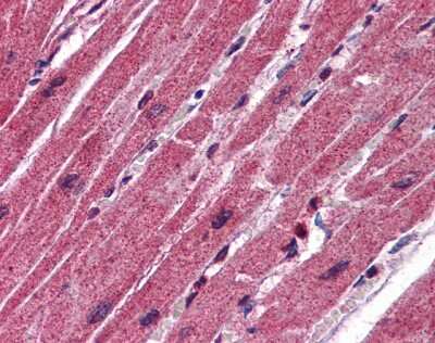 Immunohistochemistry-Paraffin: CPN1 Antibody [NBP1-57960]