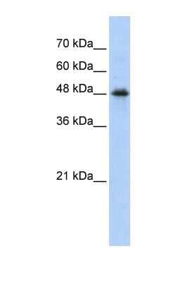 Western Blot: CPN1 Antibody [NBP1-57960]