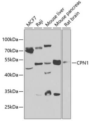 Western Blot: CPN1 AntibodyBSA Free [NBP2-92524]