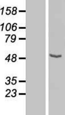 Western Blot: CPN1 Overexpression Lysate [NBL1-09440]